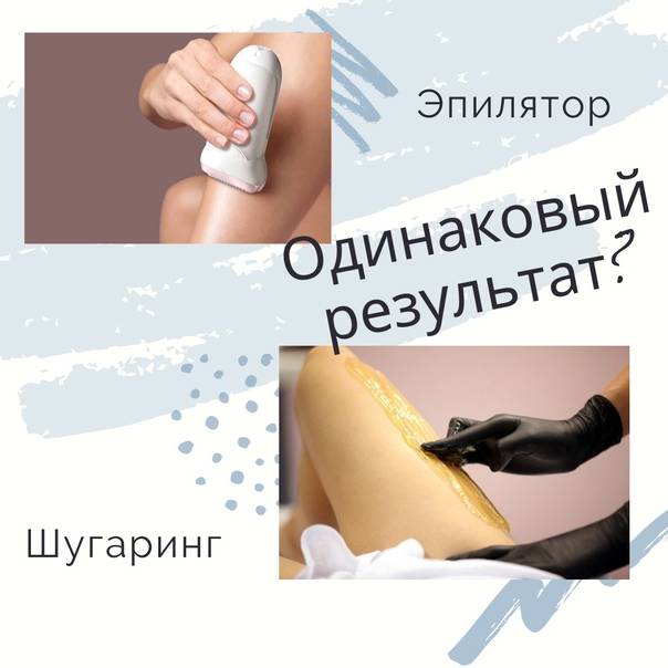 Обман в лазерной эпиляции - какие аппараты применять?